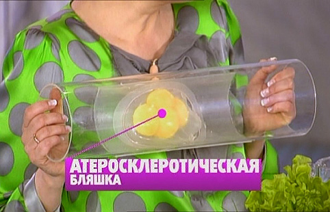 Защищаем сердце. Снижаем холестерин