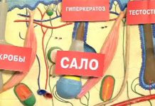 Программа «Жить Здорово» от 05.06.2014: Прыщи. Быть или не быть