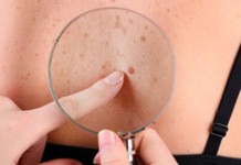 Меланома излечима! Новый препарат продлевает жизнь!