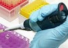 Разработан новый метод лечения гепатита С