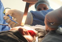 Уникальная операция по удалению челюстей у наркоманки