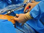 Хирургия без скальпеля и разрезов