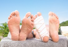 Распространенные заболевания стоп