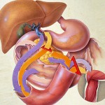 Что нужно знать о сахарном диабете 2-го типа