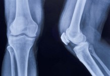 Супереда для ваших костей