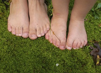 Приобретенное плоскостопие у взрослых