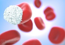 У вас повышенный холестерин. Что дальше?