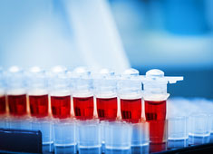 Гормональная диагностика при заболеваниях кожи и волос