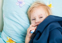 Грозит ли вам заболевание корью?