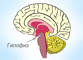 Пролактинома: диагностика и лечение