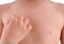 Детские болезни, которые должна знать каждая мама. Часть 1