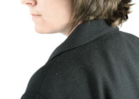 Учимся жить с псориазом