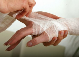 Химические ожоги