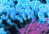 Фрамбезия. Инфекция, поражающая кости