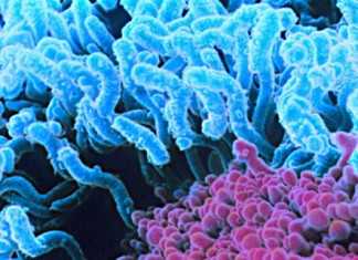 Фрамбезия. Инфекция, поражающая кости