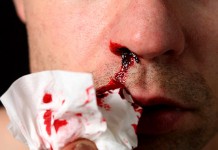 Тяжелое кровотечение