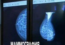 Как дальше жить? Уплотнение в груди