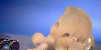 Программа "Здоровье" от 4 июня 2000 г.