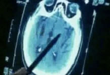 Программа "Здоровье" от 26 марта 2000 г.