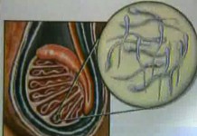 Банк спермы