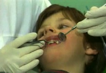 Как исправить кривые зубы?