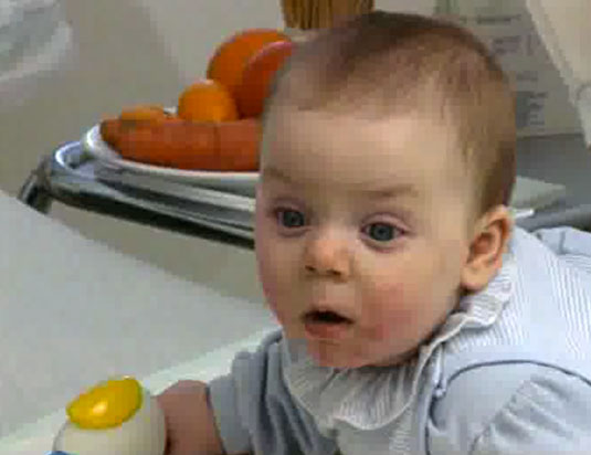 Экссудативный диатез - видео — ЗдоровьеИнфо