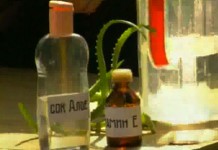 Солнечный ожог