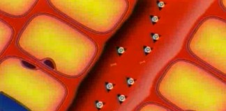 Сахарный диабет – не приговор