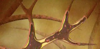 Инфаркт миокарда – венерическая болезнь?