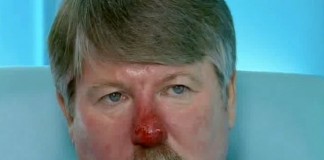 Красный нос