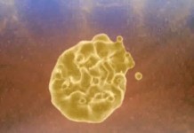 Холестерин – фактор риска