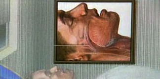 Храп – опасный недуг