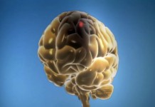 Когда счет идет на минуты. Как помочь близкому человеку