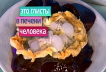 Моя ужасная счастливая история. Эхинококкоз