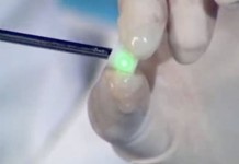 Новый метод лечения остеохондроза