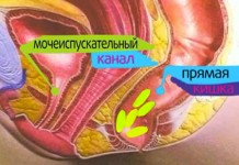 Мракоборцы. Цистит