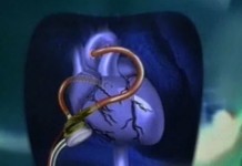 Программа "Здоровье" от 18 декабря 1998 г.