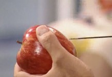 Рак предстательной железы