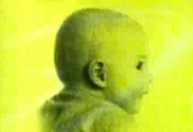 Причины бесплодия