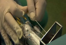 Моя ужасная счастливая история. Брахитерапия