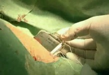 Внезапная смерть