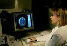 Рассеянный склероз: диагностика