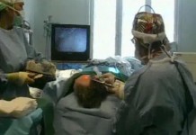 Эндоскопические пластические операции