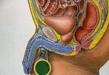 Одежда и мужское бесплодие