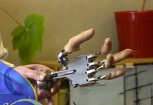 ЦНИИ протезирования