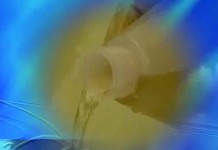 Отравления предметами бытовой химии