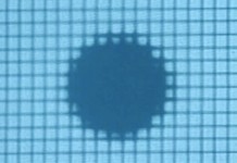 Возрастная дегенерация сетчатки