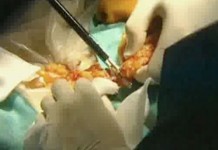 Программа "Здоровье" от 1 августа 2009 г.