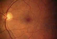 Программа "Здоровье" от 2 апреля 2005 г.