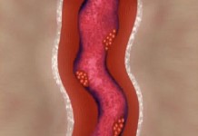 Программа "Здоровье" от 3 апреля 2004 г.